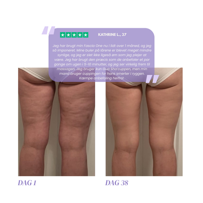 Fascia One™ by Ilha